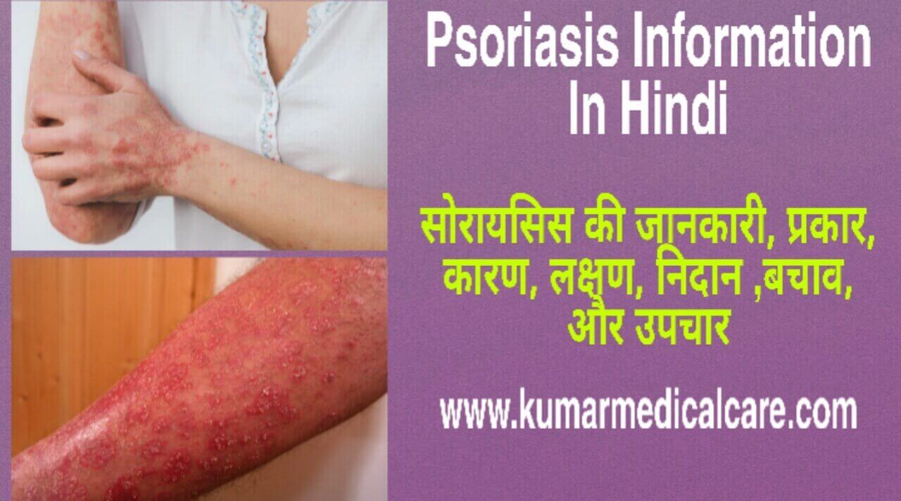 Psoriasis Information In Hindi Kumar 